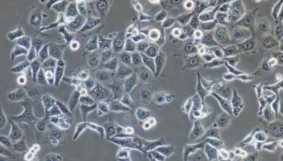 人非小細(xì)胞肺癌細(xì)胞的復(fù)蘇與傳代及凍存操作流程！