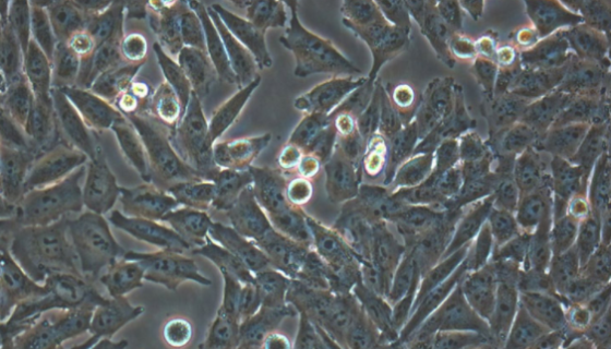 人视网膜Muller细胞接收后的处理方法与注意事项！