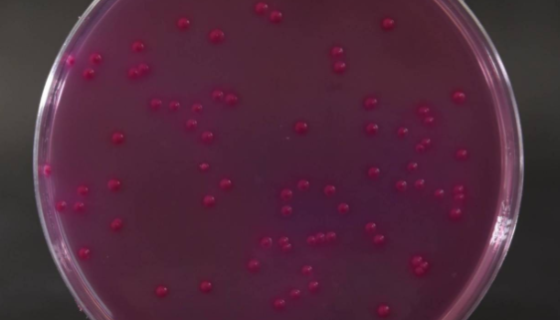 结晶紫中性红胆盐琼脂的制备方法！