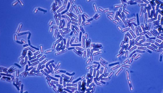 萎縮芽胞桿菌的培養(yǎng)與保藏方法及實(shí)驗(yàn)內(nèi)容！