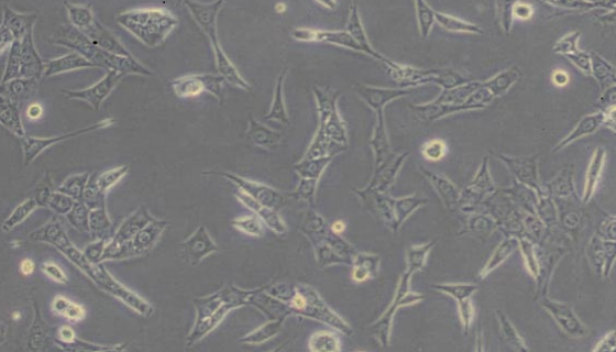 MH3924A大鼠肝癌细胞复苏与传代及冻存操作步骤！