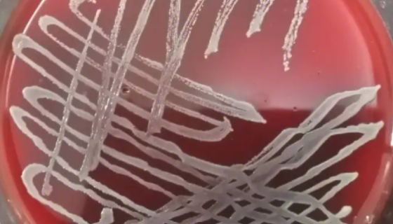 魏氏柠檬酸杆菌的培养方法与注意事项及打管说明！