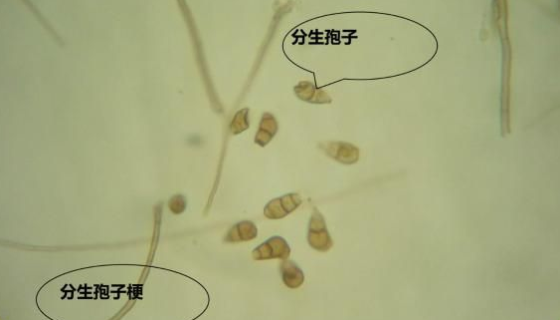 玉米大斑病菌的病原特征與流行規(guī)律及防治方法！