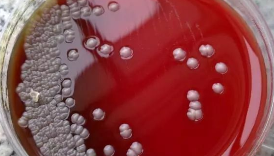 軸向海山鹽單胞菌——潛在的有機污染物降解菌