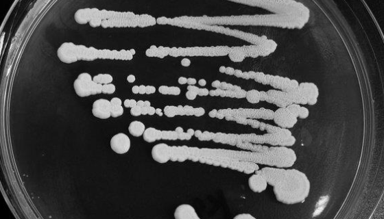 異常威克漢姆酵母與釀酒酵母在混合發(fā)酵中的相互作用機制！