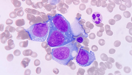 KASUMI-1人紅白血病傳代細胞系的培養(yǎng)與應用！