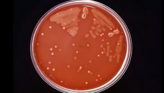 殺鮭氣單胞菌的臨床癥狀與流行特點(diǎn)及防治方法！