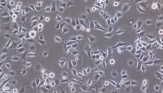 人胚胎膀胱組織來(lái)源細(xì)胞的背景與應(yīng)用！