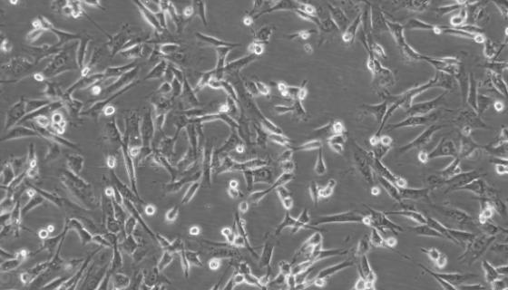 CAL-62人甲狀腺癌貼壁細(xì)胞系的培養(yǎng)操作及應(yīng)用！