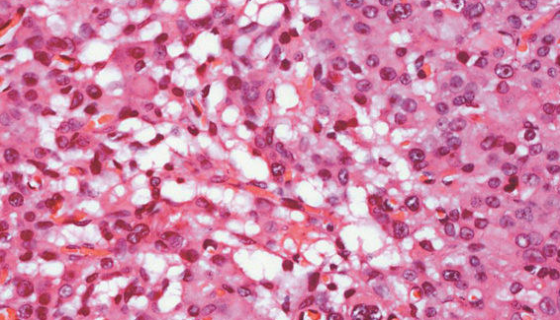 羊睪丸間質(zhì)細(xì)胞永生化的使用方法與注意事項(xiàng)！