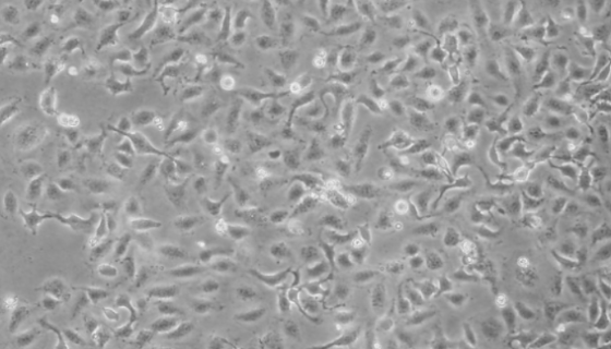 SW780人膀胱移行癌貼壁細(xì)胞系的應(yīng)用！
