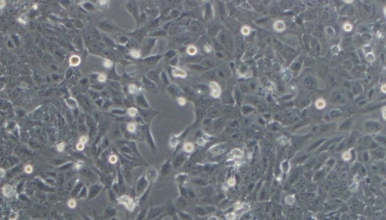 NCI-H292（人肺癌細(xì)胞(淋巴結(jié)轉(zhuǎn)移)）的應(yīng)用！