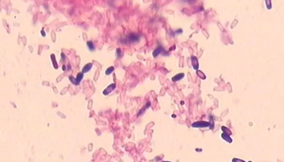 雙酶梭菌：用于分析檢測和質(zhì)量控制及細(xì)菌殺蟲劑