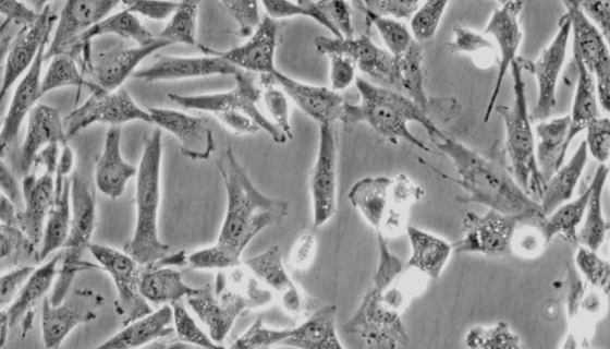 人外根鞘細(xì)胞的運輸和保存及注意事項有哪些？