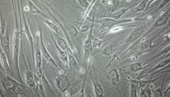 人胃成纖維細(xì)胞的特性與使用方法及收貨處理！