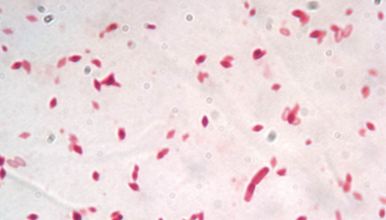 生脂固氮螺菌的特點(diǎn)與優(yōu)勢(shì)及注意事項(xiàng)有哪些？