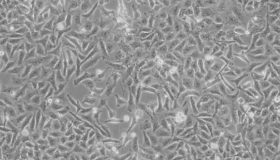 MKN7人胃癌貼壁細(xì)胞系的培養(yǎng)操作及應(yīng)用！