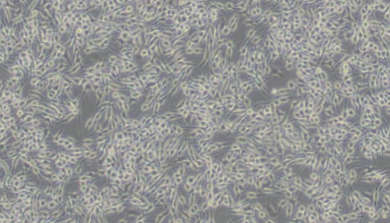 RBL-1大鼠嗜堿性粒細(xì)胞性白血病細(xì)胞的應(yīng)用！