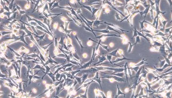 小鼠結(jié)腸上皮L細(xì)胞的培養(yǎng)操作及驗(yàn)收注意事項(xiàng)！