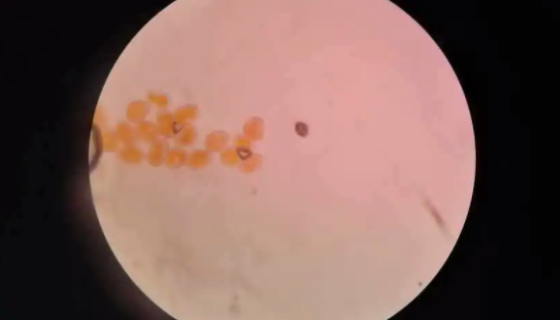 露濕漆斑菌的特征描述與傳播途徑及危害影響！