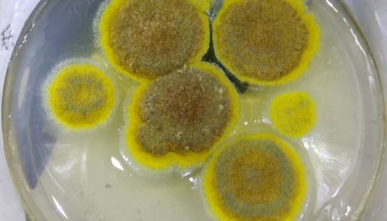 黃曲霉菌的形態(tài)特征與生長(zhǎng)環(huán)境及分布范圍！