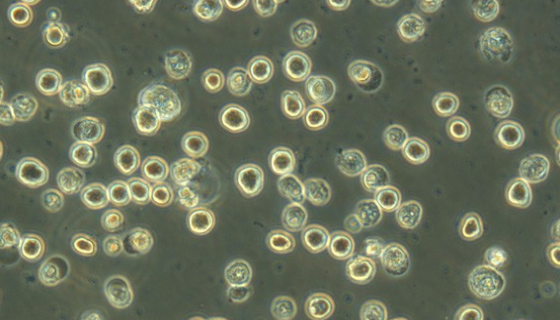 雜交瘤細(xì)胞無(wú)血清培養(yǎng)基的背景應(yīng)用及研究結(jié)果！