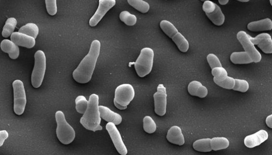 硫氧化硫桿菌的實(shí)驗(yàn)材料和方法及結(jié)果與總結(jié)！