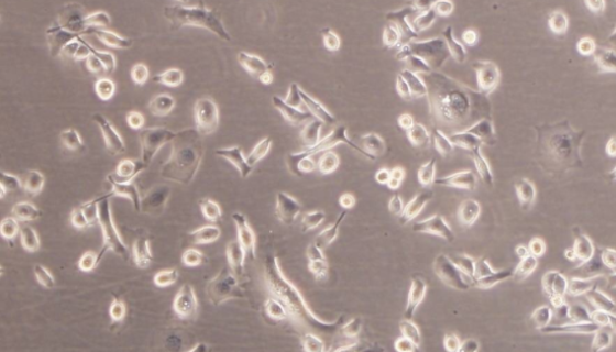 LN-18人神經膠質瘤貼壁細胞系的培養(yǎng)操作及應用！