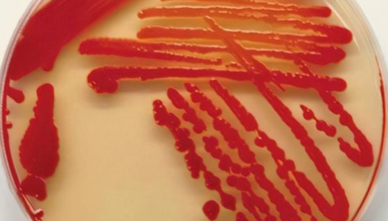 鹽沼鹽古桿菌（鹽沼沙雷氏菌）的注意事項有哪些？