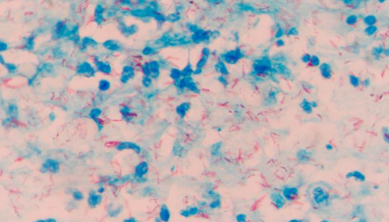 草分枝桿菌的性質特點與相互作用及注意事項！