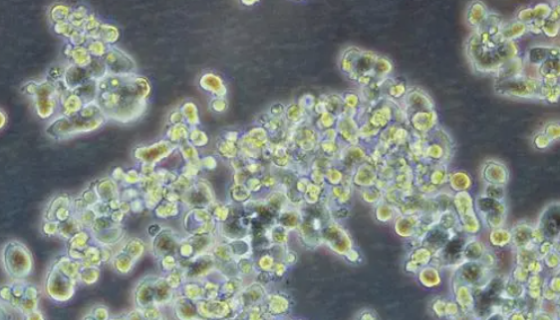 大鼠垂體瘤細(xì)胞的背景與應(yīng)用及相關(guān)研究！