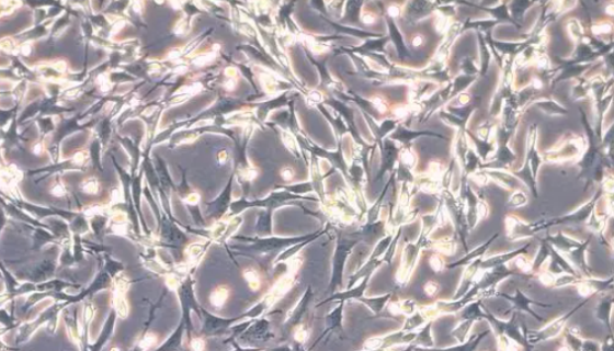 Daoy人腦髓母細(xì)胞瘤細(xì)胞的處理方法與培養(yǎng)步驟！