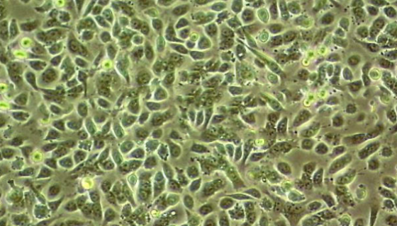 KLE人子宮內(nèi)膜癌貼壁細(xì)胞系的培養(yǎng)方法及應(yīng)用！