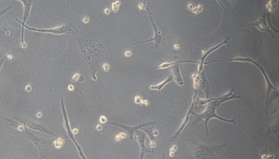 BEAS-2B人支氣管上皮細(xì)胞處理方法與培養(yǎng)步驟！