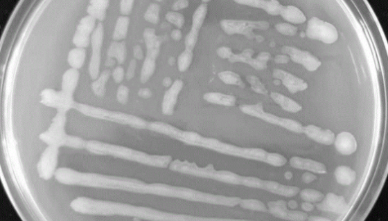 原核微生物圆褐固氮菌的知识简介与注意事项！