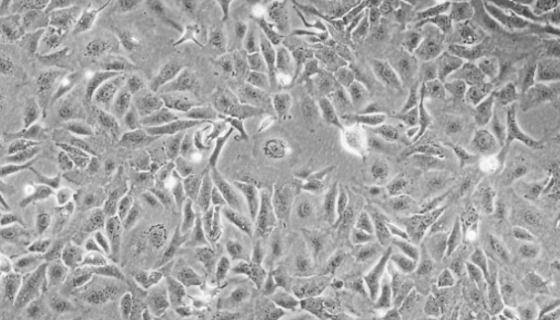 人卵巢癌细胞的培养步骤与应用及相关研究！