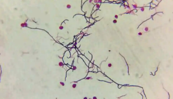 红霉素链霉菌的外形与属性及培养与保存方法！