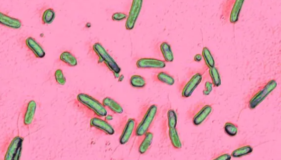 假单胞菌属的形态特性与临床意义及微生物学检验！