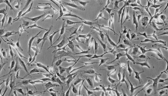 HOFCs人卵巢成纤维细胞的知识概述与应用研究！