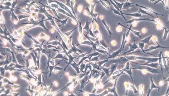 L-WRN小鼠皮下结缔组织细胞的处理与培养！