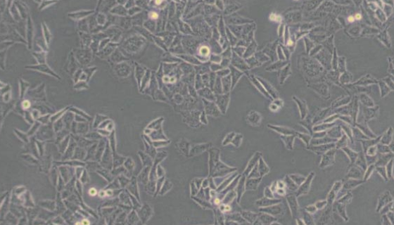 人BURKITT'S淋巴瘤細胞的培養(yǎng)操作步驟及應用！