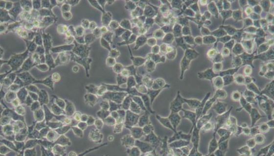 大鼠心臟微血管內皮細胞的技術背景與應用領域！