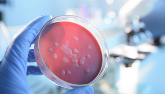 微生物检测中常见的生物化学试验方法与操作步骤！
