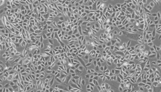 人結直腸腺癌細胞的培養(yǎng)操作步驟及應用！