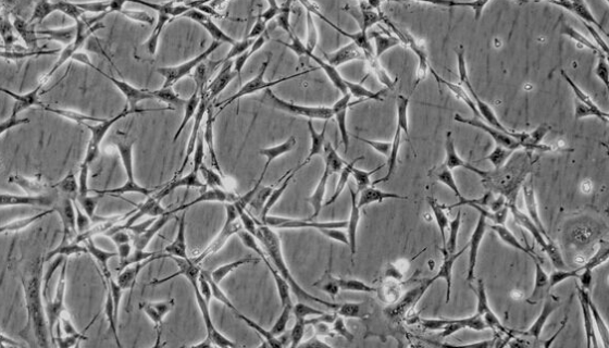 小鼠結(jié)腸平滑肌細(xì)胞的背景與應(yīng)用及作用研究！