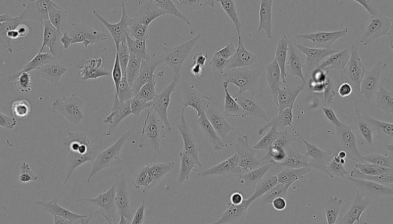 SP2/0-AG14小鼠骨髓瘤貼壁細(xì)胞系的培養(yǎng)與應(yīng)用！