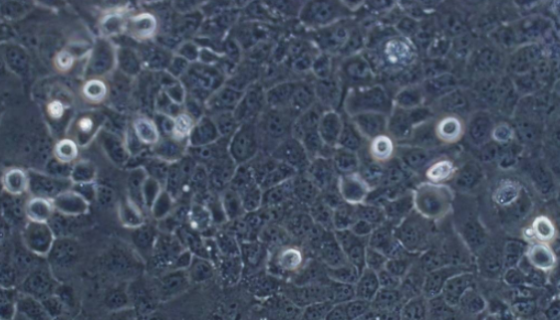 THLE-2人肝永生化貼壁細(xì)胞系的應(yīng)用及相關(guān)研究！