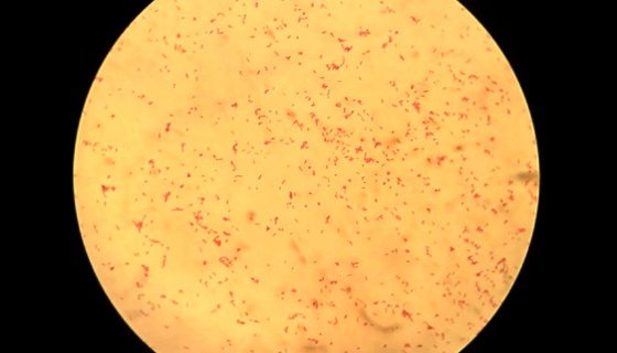 野油菜黃單孢菌的特點(diǎn)與優(yōu)勢(shì)及微生物培養(yǎng)方法！