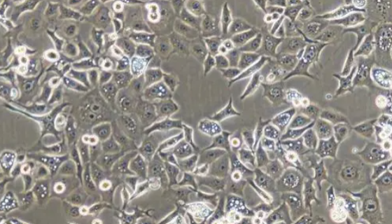 人食管鱗癌細(xì)胞的背景與應(yīng)用及培養(yǎng)操作步驟！