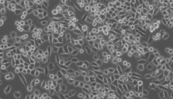 人胰腺癌細(xì)胞的培養(yǎng)操作與應(yīng)用及研究動(dòng)態(tài)！